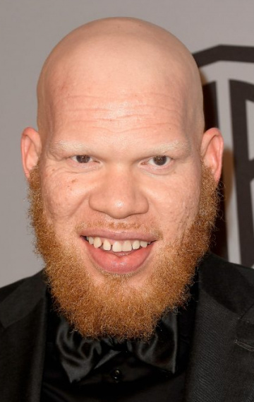 Актер Марвин &laquo;Крондон&raquo; Джонс III